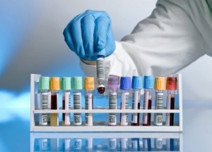 Lab