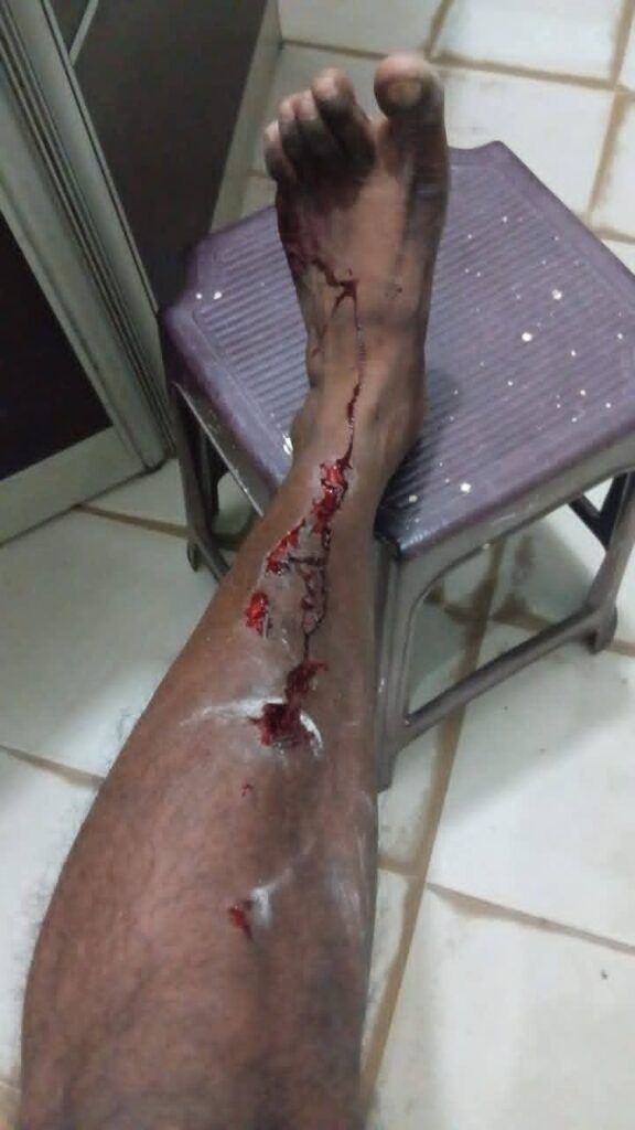 FB IMG 1758980079822